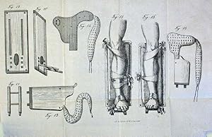 Mémoire sur l'hyponarthécie, sur le traitement des fractures par la planchette, avec une nouvelle...