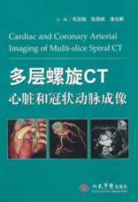 Imagen del vendedor de The heart and coronary multi-slice CT imaging (fine)(Chinese Edition) a la venta por liu xing