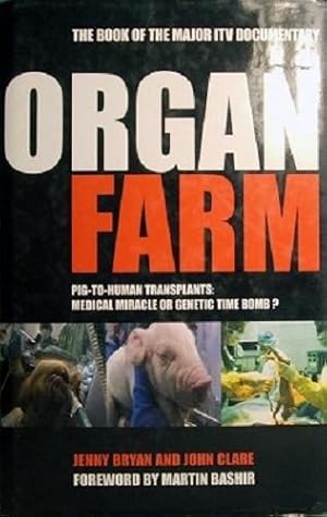 Organ Farm: Pig To Human Transplants