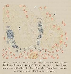 Bacteriologische Untersuchungen über Septische Processe des Kindesalters.