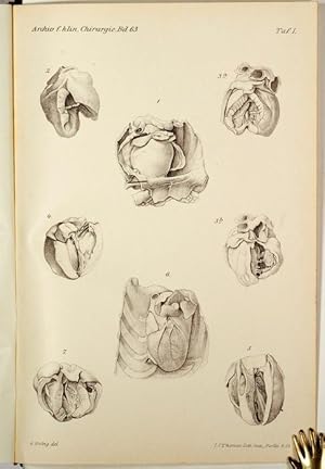 Beitrag zur Frage der Fremdkörper im Herzen, Von W.A. v. Oppel (pp.87-115, 1 lith. Tafel mit 8 Ab...