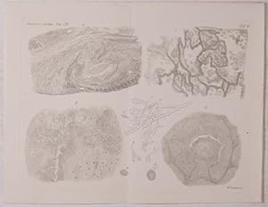 Bild des Verkufers fr Mycosis mucorina. Ein Beitrag zur Kenntniss der menschlichen Fadenpilzkrankheit (pp.543-564, 1 Taf.). zum Verkauf von Antiq. F.-D. Shn - Medicusbooks.Com