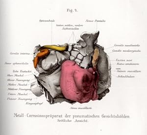 Imagen del vendedor de Beitrge zur Corrosionsanatomie der pneumatischen Gesichtshhlen. a la venta por Antiq. F.-D. Shn - Medicusbooks.Com
