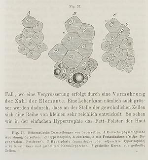 Bild des Verkufers fr Die Cellularpathologie in ihrer Begrndung auf physiologische und pathologische Gewebelehre. Zwanzig Vorlesungen gehalten whrend der Monate Februar, Mrz, April 1858 im pathologischen Institute zu Berlin. zum Verkauf von Antiq. F.-D. Shn - Medicusbooks.Com