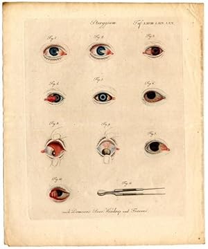 Image du vendeur pour Pterygium. Zur Erluterung der verschiedenen Formen von Flgelfellen nach Demours, Berer, Wardrop und Travers. mis en vente par Antiq. F.-D. Shn - Medicusbooks.Com