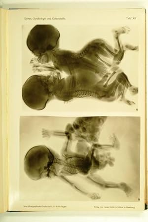 Die Röntgenstrahlen in Gynäkologie und Geburtshilfe. Mit einem Vorwort von C.Menge.
