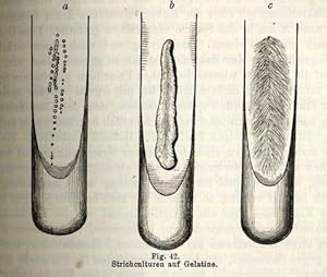 Die Mikroorganismen. Mit besonderer Berücksichtigung der Aetiologie der Infectionskrankheiten.