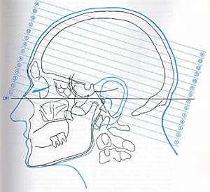 Bild des Verkufers fr Neuroanatomie der kraniellen Computertomographie. Grundlagen und klinische Anwendung. zum Verkauf von Antiq. F.-D. Shn - Medicusbooks.Com