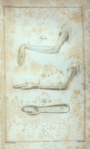 Imagen del vendedor de A Practical Treatise on Various Diseases of the Abdominal Viscera a la venta por Barter Books Ltd