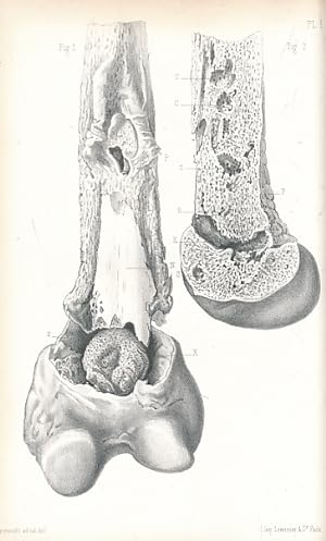Image du vendeur pour Anatomie Pathologique des Ostites mis en vente par Barter Books Ltd