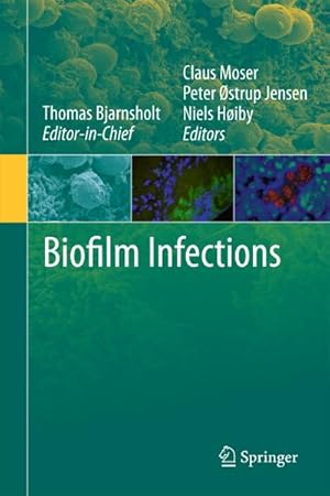 Immagine del venditore per Biofilm Infections venduto da BuchWeltWeit Ludwig Meier e.K.