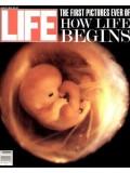 Life Magazine 1 August 1990 Fetus 8/1/90