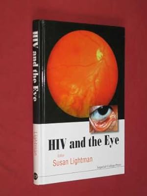 Immagine del venditore per HIV and the Eye venduto da BOOKBARROW (PBFA member)