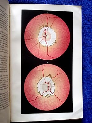 Immagine del venditore per Guy's Hospital Reports, 1870 - 1871, Third Series, Vol XVI, venduto da Tony Hutchinson