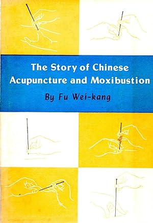 The Story of Chinese Acupuncture and Moxibustion