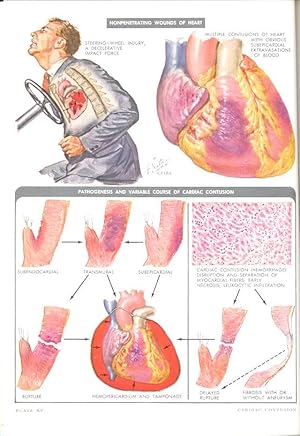 Image du vendeur pour Clinical Symposia Anthology. [Treatment of Head Injuries; Rheumatoid Arthritis; Thoracic-Outlet Syndromes; Syphilis; Chest Trauma; Otologic Diagnosis and the Treatment of Deafness] mis en vente par Joseph Valles - Books