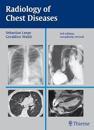 Bild des Verkufers fr Radiology of Chest Diseases zum Verkauf von AHA-BUCH GmbH