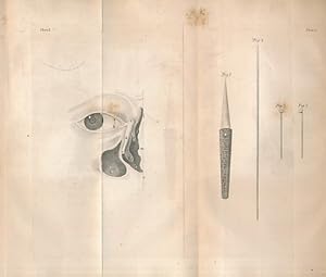 Image du vendeur pour Observations on the Treatment of the Epiphora, or Watery Eye; and on the Fistula Lacrymalis: Together with Remarks on the Introduction of the Male Catheter, and on the Treatment of Haemorrhoids mis en vente par Barter Books Ltd