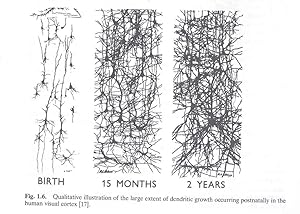 Brain, behaviour, and iron in the infant diet. [Vulnerable periods in developing brain -- The epi...