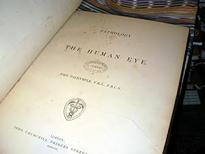 Pathology of the Human Eye: John Dalrymple