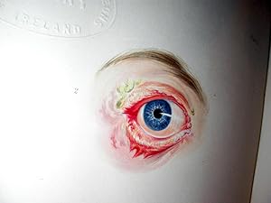 Pathology of the Human Eye: John Dalrymple