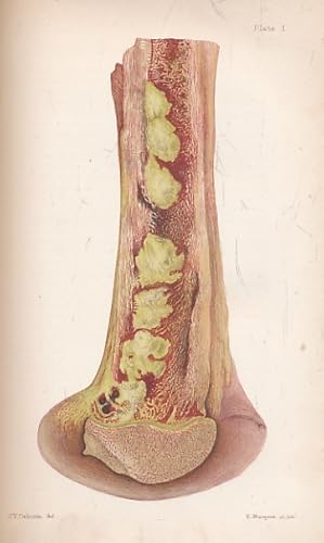 Image du vendeur pour Diseases of Bones and Joints mis en vente par Barter Books Ltd