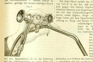 Ein biegsames Gastroskop (pp.433-441, 7 Abb.).