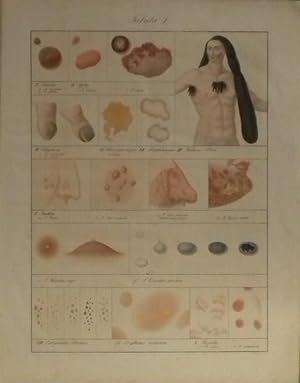 Synopsis morborum cutaneorum secundum classes, genera, species et varietates. - Übersicht der Hau...