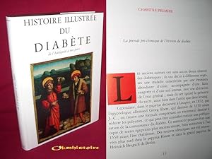 Histoire Illustrée du Diabète, de l' Antiquité à nos jours. Préface de Georges Tchobroutsky.