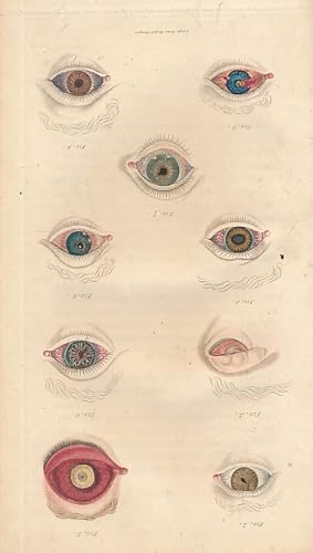 Seller image for A Manual of the Diseases of the Human Eye, Intended for Surgeon's Commencing Practice, from the Best National and Foreign Works. 2 volume set for sale by Barter Books Ltd