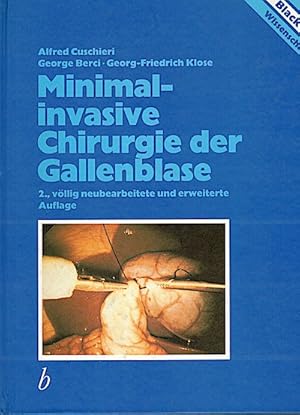 Seller image for Minimalinvasive Chirurgie der Gallenblase : mit 19 Tabellen for sale by Versandbuchhandlung Kisch & Co.