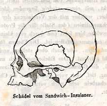 Bild des Verkufers fr Bemerkungen ber die Schdelform der Iberier, nebst anderen ber den Schdel eines Sandwich-Insulaners und ber die Schdel der sogenannten Flachkopf-Indianer. Aus dem Schwedischen von Fr. Creplin. zum Verkauf von Antiq. F.-D. Shn - Medicusbooks.Com