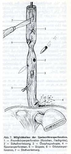 Seller image for Spezielle Chirurgie fr die Praxis. 1/1.Bd.: Allgemeines - Kopf - Hals - Mediastinum. for sale by Antiq. F.-D. Shn - Medicusbooks.Com