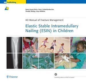 Imagen del vendedor de Elastic Stable Intramedullary Nailing (ESIN) in Children a la venta por AHA-BUCH GmbH