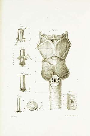 Essai sur la bronchotomie et les cas qui la nécessitent, le croup en particulier. Thèse présentée...