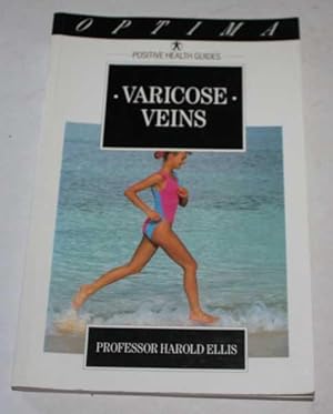 Varicose Veins