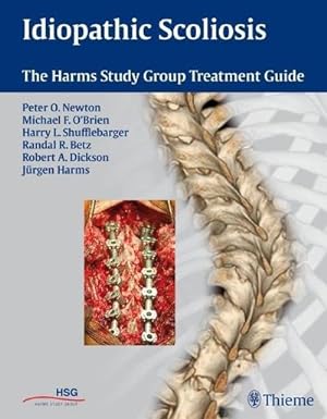 Bild des Verkufers fr Idiopathic Scoliosis : The Harms Study Group Treatment Guide zum Verkauf von AHA-BUCH GmbH