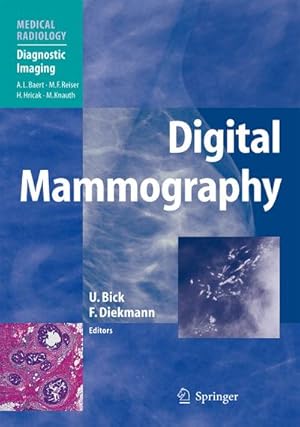 Seller image for Digital Mammography for sale by AHA-BUCH GmbH