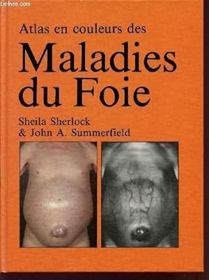 Bild des Verkufers fr ATLAS EN COULEURS DES MALADIES DU FOIE. zum Verkauf von Le-Livre