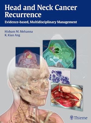 Seller image for Head and Neck Cancer Recurrence : Evidence-based, Multidisciplinary Management for sale by AHA-BUCH GmbH