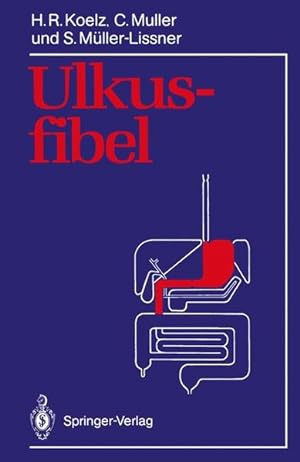 Ulkusfibel (German Edition)