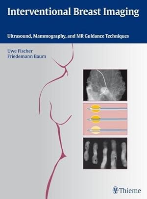 Immagine del venditore per Interventional Breast Imaging : Ultrasound, Mammography, and MR Guidance Techniques venduto da AHA-BUCH GmbH