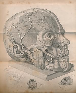 Image du vendeur pour A Treatise on the Principle Diseases of the Eyes mis en vente par Barter Books Ltd