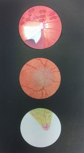 Image du vendeur pour Diseases of the Eye. Part I. Referring Principally to Those Affections Requiring the Aid of the Ophthalmoscope for their Diagnosis mis en vente par Barter Books Ltd