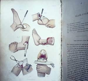 Image du vendeur pour Dictionary of Practical Surgery by Various Hospital Surgeons. Volume I Only mis en vente par Barter Books Ltd