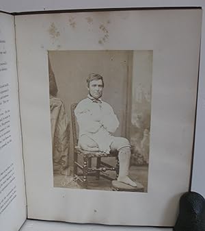 Image du vendeur pour History of a Successful Case of Amputation at the Hip-Joint, (The Limb 48 Inches in Circumference, 99 Pounds Weight). mis en vente par Scientia Books, ABAA ILAB