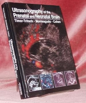 Immagine del venditore per Ultrasonography of the Prenatal and Neonatal Brain. venduto da Bouquinerie du Varis