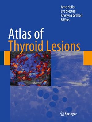 Immagine del venditore per Atlas of Thyroid Lesions venduto da AHA-BUCH GmbH