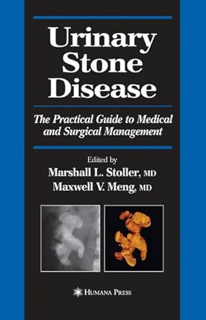 Immagine del venditore per Urinary Stone Disease : The Practical Guide to Medical and Surgical Management venduto da AHA-BUCH GmbH