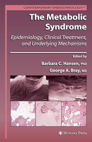 Seller image for The Metabolic Syndrome: : Epidemiology, Clinical Treatment, and Underlying Mechanisms for sale by AHA-BUCH GmbH